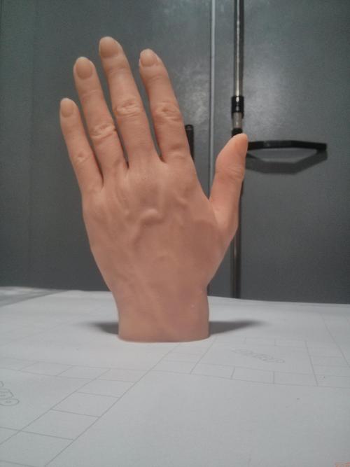 假肢廠家安裝手指假肢時(shí)要注意哪些問(wèn)題(圖1)