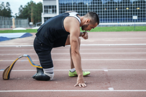 截肢患者初次安裝假肢時(shí)注意什么怎么做較好(圖1) 截肢患者初次安裝假肢時(shí)注意什么怎么做較好(圖1)