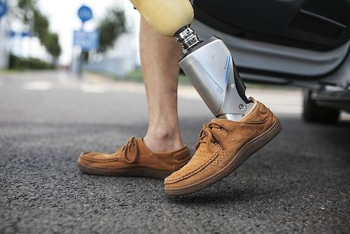 假肢價格多少錢初次安裝假肢應(yīng)該如何做呢?(圖1)